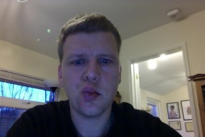 Day 10 - Blowing a Kiss Bells-palsy-day-10-blow-kiss