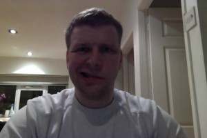 Day 6 - Smiling Face Day 6 Bells Palsy Pictures Smiling Face