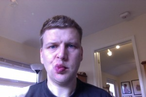 Bells Palsy Day 9 Blowing A Kiss Picture
