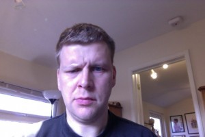 Day 9 Frowning Attempt Bells Palsy Day 9 Frowning Attempt