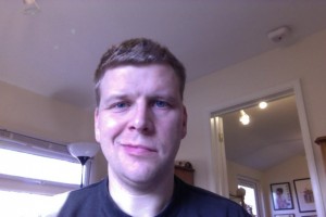 Day 9 Smile Attempt Bells Palsy Day 9 Smiling Face