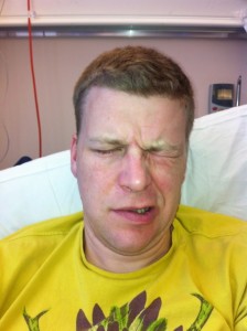 Day 1 - trying to shut my eyes day1-bells-palsy-eye-shut