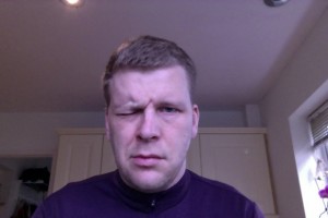 Trying to frown with Bells Palsy - Day 4