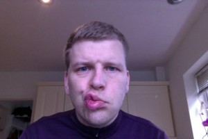 Trying to blow a kiss on day 4 with Bells Palsy