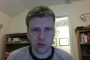 Bells palsy day 21 kiss